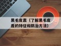 黑毛皮蠹（了解黑毛皮蠹的特征和防治方法）