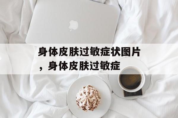身体皮肤过敏症状图片，身体皮肤过敏症-第1张图片-